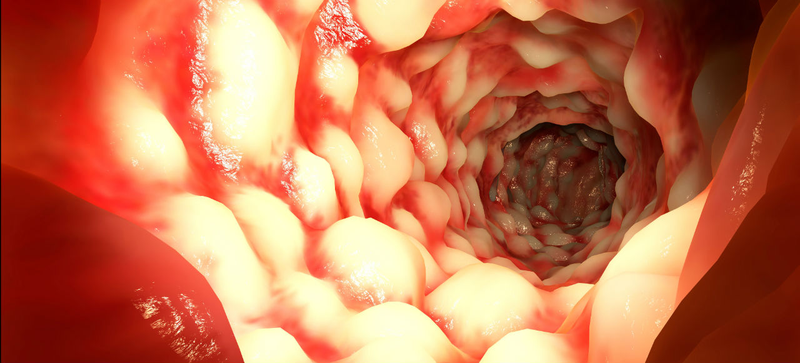 Illustration for article titled Finding, Treating, and Beating the Most Survivable Forms of Cancer